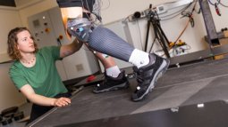 Biomedical Engineering student conducts measurements on a patient with a new prosthesis on a treadmill.