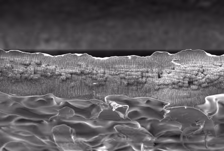 Building blocks of a membrane